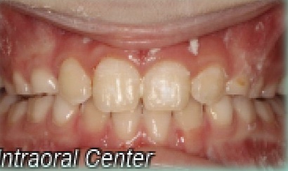 After image