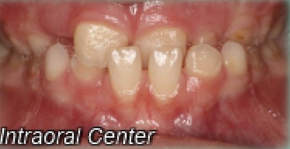 Before image